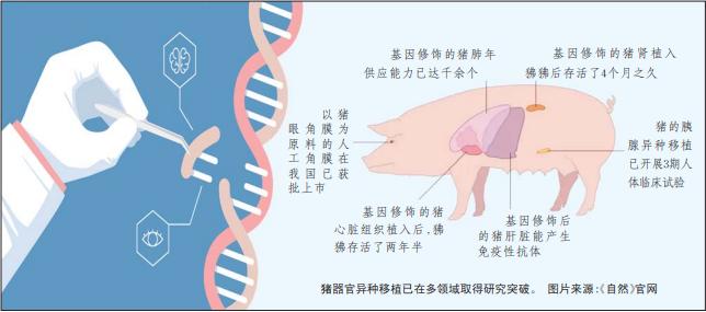 中国实现猪肾与肝移植人体，再生医学迈入新纪元